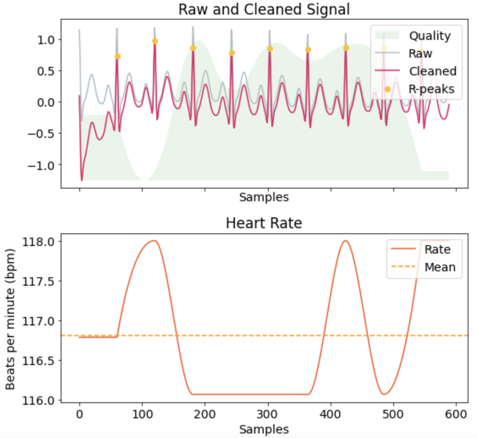 ECG signal analysis for digital twin